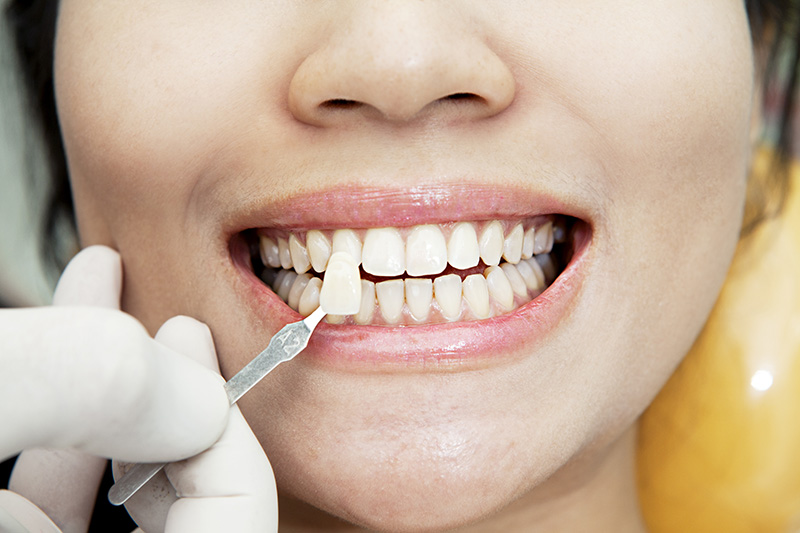 Эстетическая стоматология: как исправить проблемы с зубами - TwitNow.ru